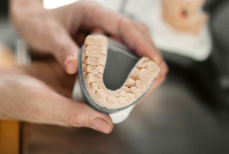 Mouth Guards, Winnipeg Dentist